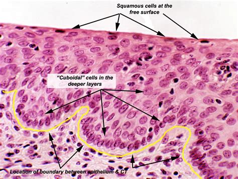 Epithelial Tissue Locations Stratified Squamous Epithelium Histology ...