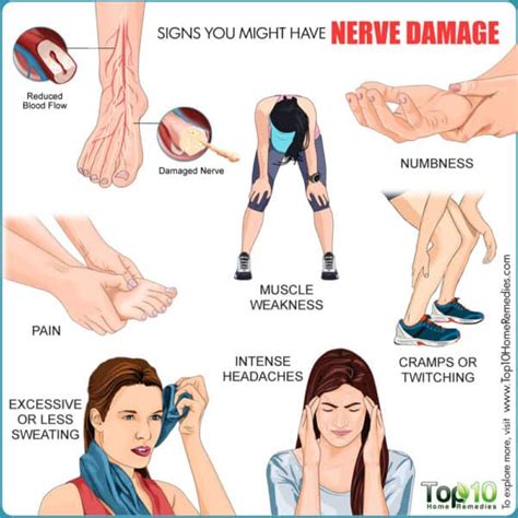 Nerve Damage: Causes, Symptoms, and Complications | Top 10 Home Remedies