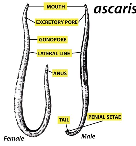 Elephantiasis is caused by:(a)Ascaris(b)Pinworm(c)Filarial worms(d)Hookworm