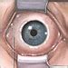 Chemosis - Symptoms, Causes, Tests - NY Times Health Information