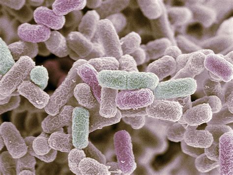 Free photo: Escherichia coli - Analysis, Microbial, Inspection - Free ...