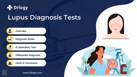 What is the role of antibody tests in lupus diagnosis?