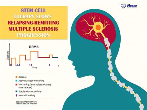 Stem Cell Therapy Slows Relapsing-remitting Multiple Sclerosis Progression