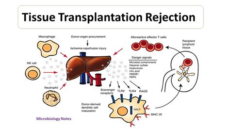 Tissue Transplantation Rejection | Rejection, Microbiology, Tissue