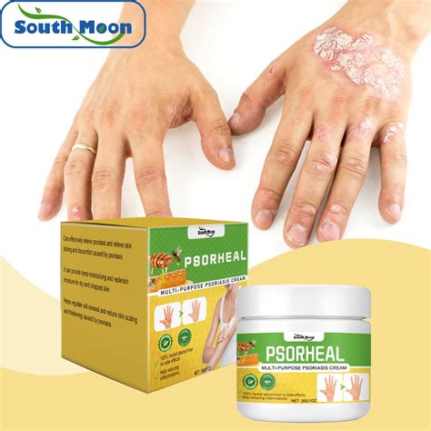 Psoriasis Soothing Cream Antibacterial Effective Anti Itching Rash ...