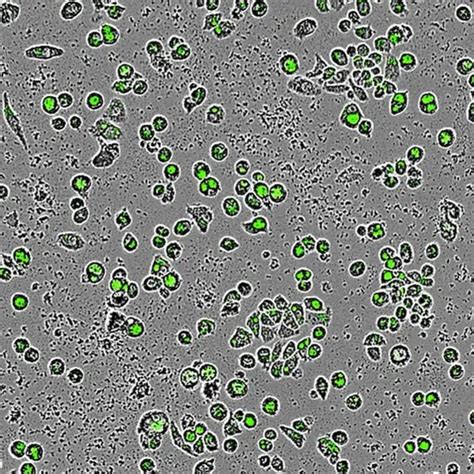 Phagocytosis Microscope