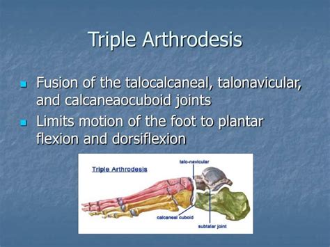 PPT - Orthopedic Surgery PowerPoint Presentation - ID:1747320