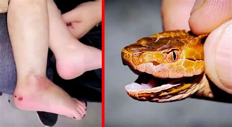 Venomous Copperhead Snake Bites 2-Year-Old Boy In South Carolina