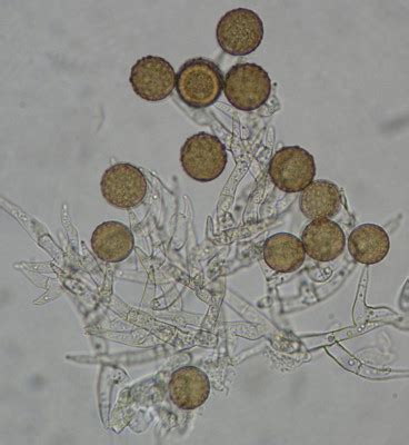 Fungal Spores Under Microscope