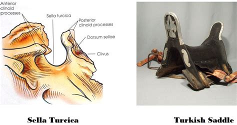 Sella Turcica Anatomy