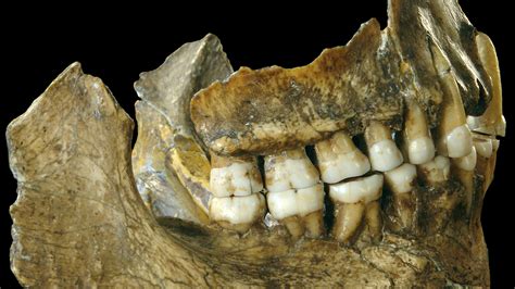 Early Hominids Teeth