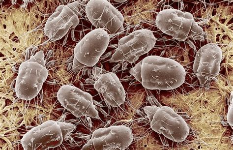 5 facts you should know about the dust mites in your home | XL Cleaners