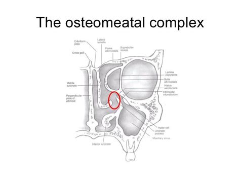 The ostiomeatal complex (or unit) is common channel that links the ...