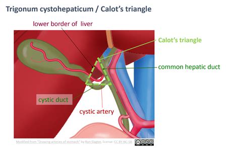 Leiden - Drawing Calot's triangle - English labels | AnatomyTOOL