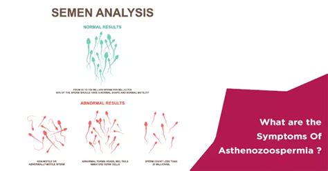 What are The Signs and Symptoms of Asthenozoospermia | Nova IVF Fertility