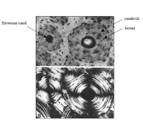 Osteon Histology