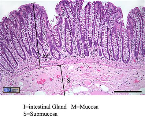 43 best Histology - Small Intestine images on Pinterest