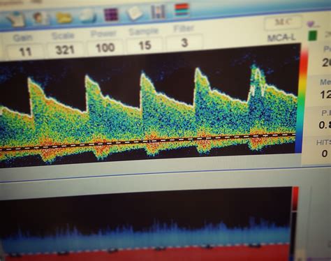 Transcranial Doppler Ultrasound Timing Critical for Beneficial Outcomes ...