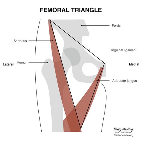 Femoral Canal Anatomy