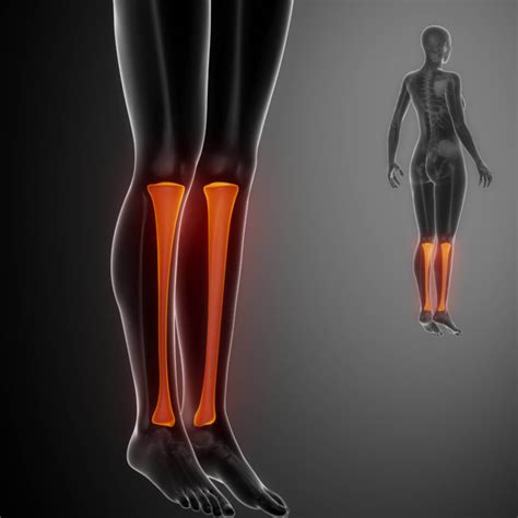 Leg injuries & conditions our practitioners diagnose & treat @WHP