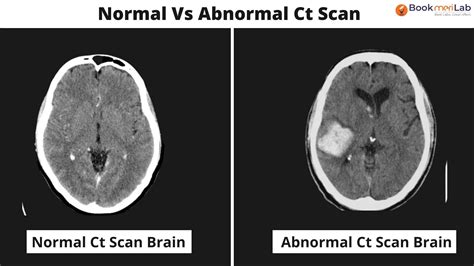 CT Scan Brain: Purpose, Results & Cost [2024] • Bookmerilab