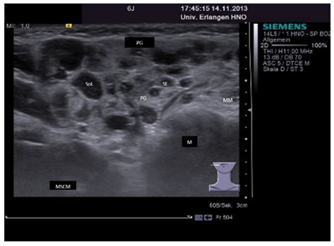 JCM | Free Full-Text | Ultrasound in Inflammatory and Obstructive ...