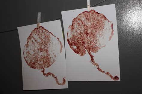 Placenta Prints - Placenta Encapsulation Services