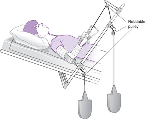 Traction | Nurse Key