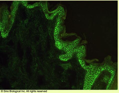 EGFR Antibody Guideline: Preparation, Dilution and Applications | Sino ...