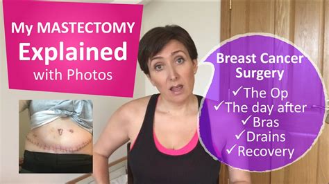 My breast cancer lumpectomy, mastectomy and reconstruction, before and ...