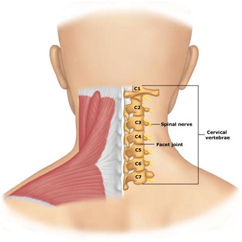 Herniated Disk Neck Surgery - Explanation, Results, Process