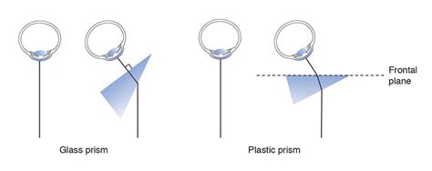 Introduction To Clinical Prisms — Ophthalmology Review