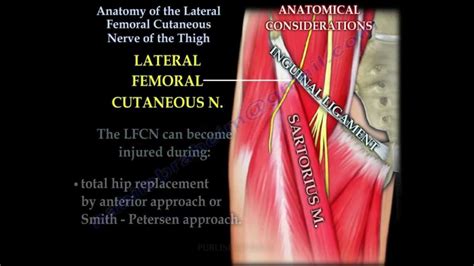 Pinched Nerve: Thigh Pinched Nerve