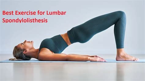 12 Best Exercise for Lumbar Spondylolisthesis - Mobile Physio