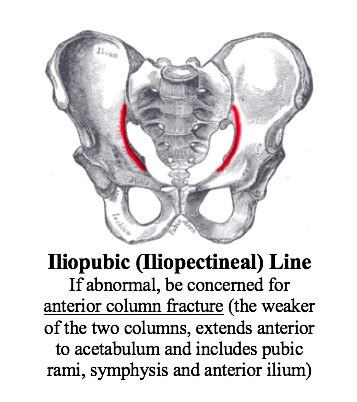 Back to Basics: Pelvic XRays — Taming the SRU