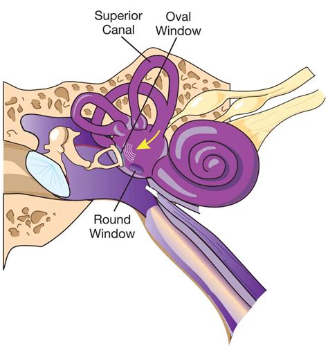 Perilymph fistula causes, symptoms, diagnosis, treatment & prognosis