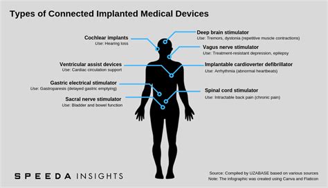 SPEEDA | Body Talks: The Future of the Connected Implanted Medical ...