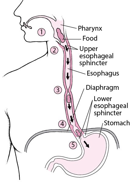 Esophageal Spasm - Digestive Disorders - MSD Manual Consumer Version