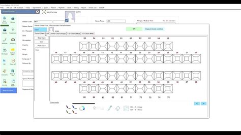 Tooth Charting Sheet