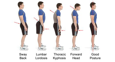 6 Exercises to Help "Fix" Bad Posture