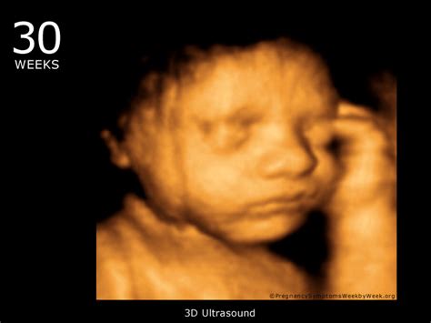 3D Ultrasound: Video Of 3d Ultrasound