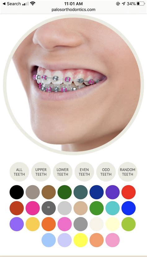 braces rubber band colors that make your teeth look whiter - Manie Blalock