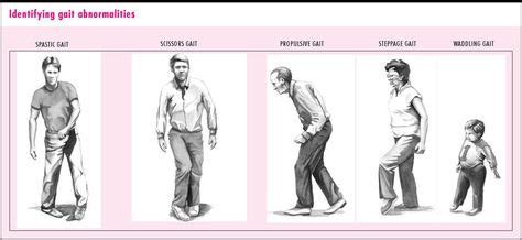 images of abnormal gait patterns | gait abnormalities 1 parkinsonian ...