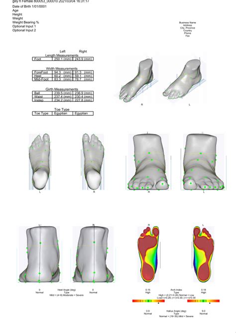 3D Scans - Footwear Solutions