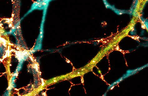 Super-resolution microscopy - Neurophotonics Centre