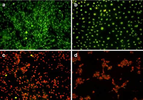 Fluorescence images of acridine orange and ethidium bromide staining. a ...