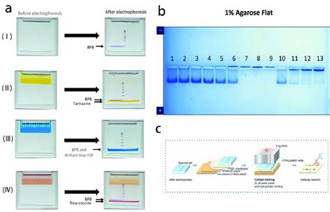 Polyacrylamide gel electrophoresis and agarose gel electrophoresis for ...