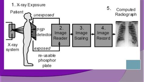 Cr Reader Radiology / Radiological imaging of the neonatal chest, 2nd ...