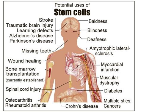 How are Stem Cells Used | Stemology