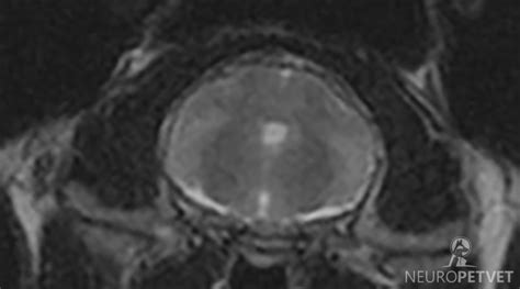 Term: Lissencephaly - NeuroPetVet